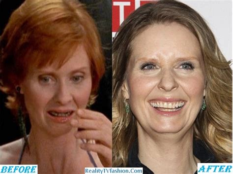 cynthia nixon teeth